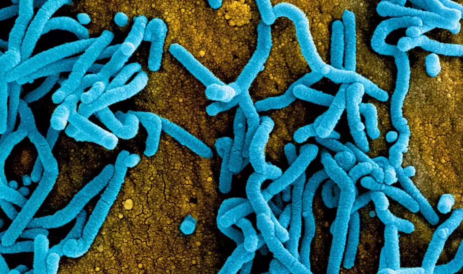 Fears soar as deadly ‘eye-bleeding’ disease spreads into Europe as 9 killed